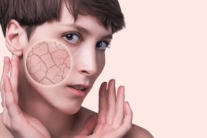 עור יבש כל הדרכים הנכונות לטיפול